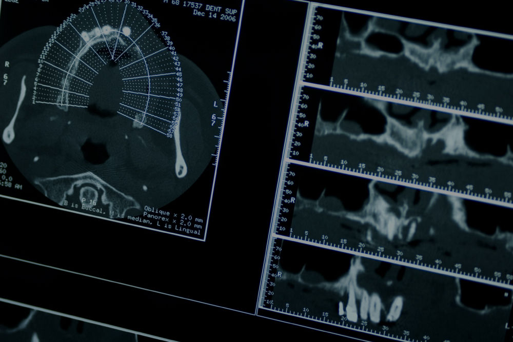 radiologia