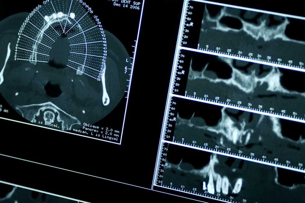 radiologia